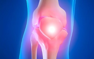 Ursachen der Arthrose des Kniegelenks